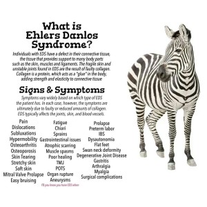Ehlers Danlos Symptoms
