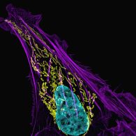 A microscope view of a cell in purple, green and yellow.