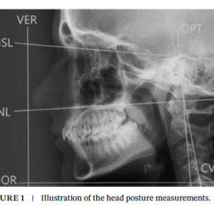 A radiographic image of the left side of a human skull with lines running from various features creating angles that are labeled.