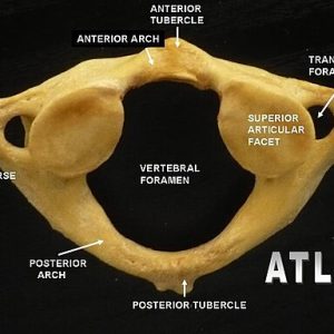 A view of the atlas vertebra from above with anatomical sparts labeled.