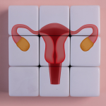 Illustration of a uterus and ovaries overlaid on a grid of white tiles, symbolizing the shift from viewing PCOS as an ovarian condition alone to recognizing PMOS as a complex multisystem endocrine and metabolic disorder.