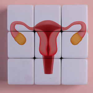 Illustration of a uterus and ovaries overlaid on a grid of white tiles, symbolizing the shift from viewing PCOS as an ovarian condition alone to recognizing PMOS as a complex multisystem endocrine and metabolic disorder.