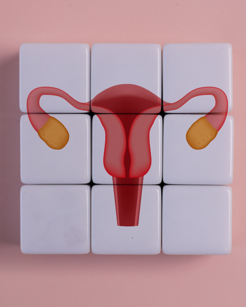 Illustration of a uterus and ovaries overlaid on a grid of white tiles, symbolizing the shift from viewing PCOS as an ovarian condition alone to recognizing PMOS as a complex multisystem endocrine and metabolic disorder.