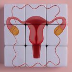 Illustration of a uterus and ovaries overlaid on a grid of white tiles with a red squiggly line around it all, symbolizing the shift from viewing PCOS as an ovarian condition alone to recognizing PMOS as a complex multisystem endocrine and metabolic disorder.